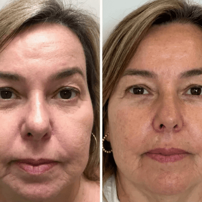 Máscara Coreana de Colágeno Rejuvenescedora Peel Off - Collagen Fit™