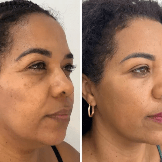 Máscara Coreana de Colágeno Rejuvenescedora Peel Off - Collagen Fit™